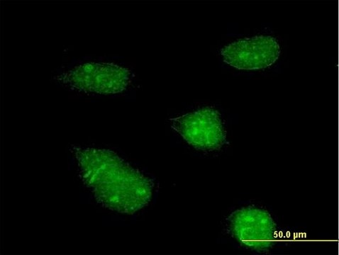 Monoclonal Anti-HDAC9 antibody produced in