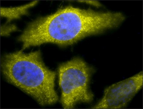 Monoclonal Anti-Tcp1 Alpha - Percp