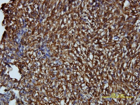 Monoclonal Anti-LDLRAP1 antibody produced in