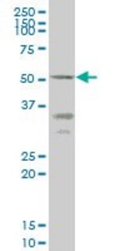 Monoclonal Anti-ENTPD5 antibody produced in