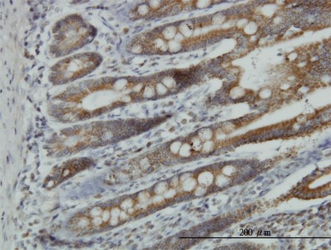 Monoclonal Anti-NDUFA9 antibody produced in