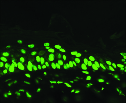 Monoclonal Anti-Acetylated Lysine antibody produced
