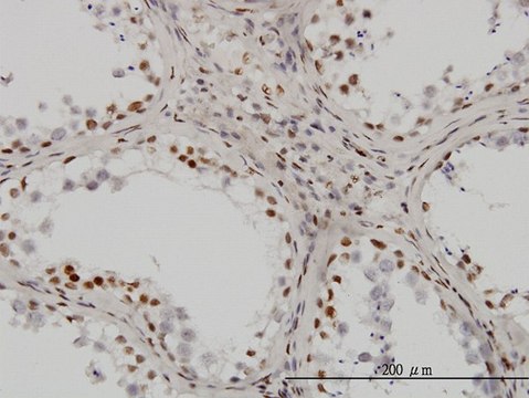 Monoclonal Anti-UBTF antibody produced in