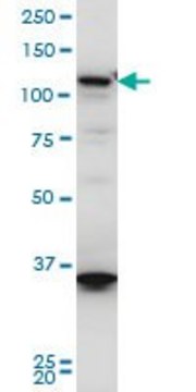 Monoclonal Anti-HIP1R antibody produced in