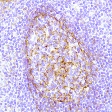 Anti-B7-H3/CD276 antibody, Rabbit monoclonal