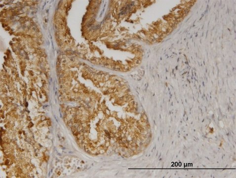 Monoclonal Anti-AGTRAP antibody produced in