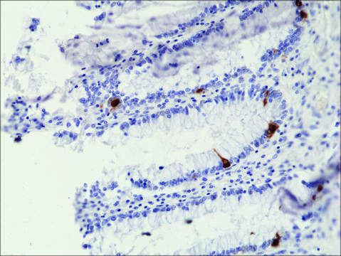 Anti-Chromogranin A antibody, Rabbit monoclonal