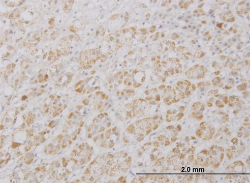 Monoclonal Anti-DKFZp761P0423 antibody produced in