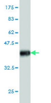 Monoclonal Anti-IL6R antibody produced in