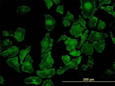 Monoclonal Anti-ROCK1 antibody produced in