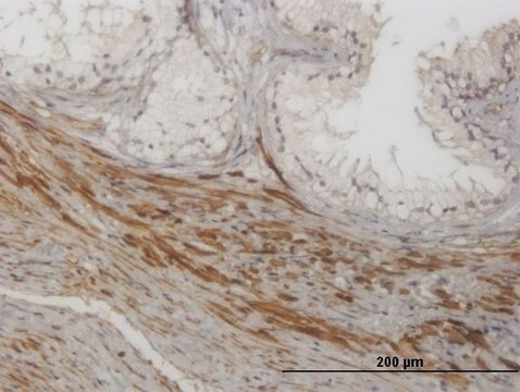 Monoclonal Anti-NKIRAS1 antibody produced in
