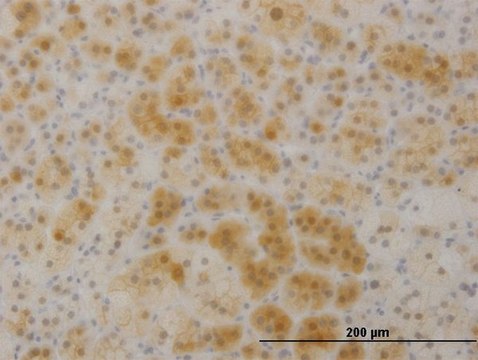 Monoclonal Anti-TTC1 antibody produced in