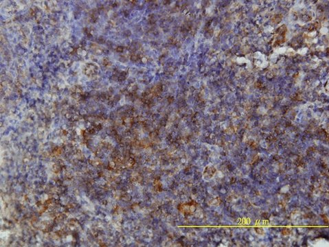 Monoclonal Anti-GSDMDC1 antibody produced in