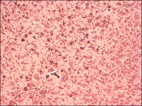 Monoclonal Anti-KCNB1 antibody produced in