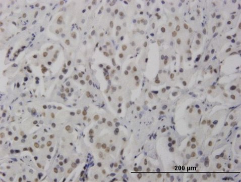 Monoclonal Anti-RNF168 antibody produced in