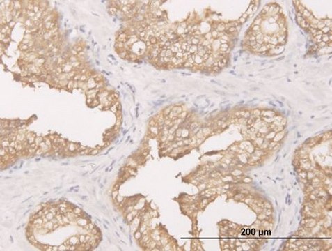 Monoclonal Anti-DCXR antibody produced in