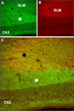 Anti-GABAB Receptor 2 antibody produced
