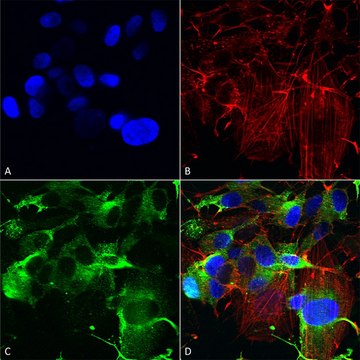 Monoclonal Anti-Gfap R416Wt antibody produced
