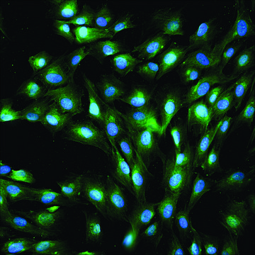 Anti-Rabbit IgG (whole molecule)–FITC antibody