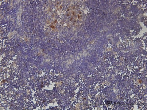 Monoclonal Anti-KIAA0101 antibody produced in
