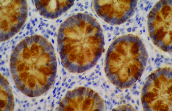 Monoclonal Anti-Blood Group Lewis a