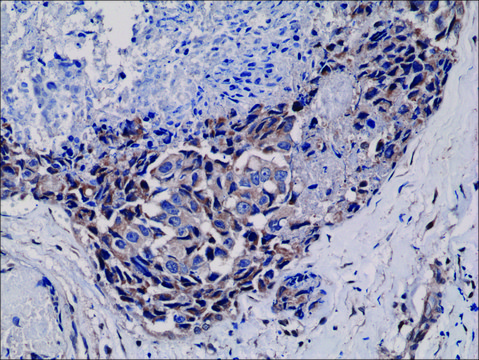 Anti-Phospho-akt (ser473) antibody, Rabbit monoclonal