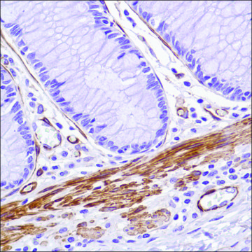 Anti-Caldesmon-Pan antibody, Rabbit monoclonal