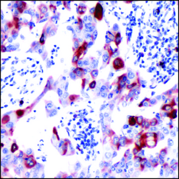 Anti-S6 Ribosomal Protein (phospho S240/244)