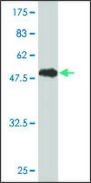 Monoclonal Anti-GSTT1 antibody produced in