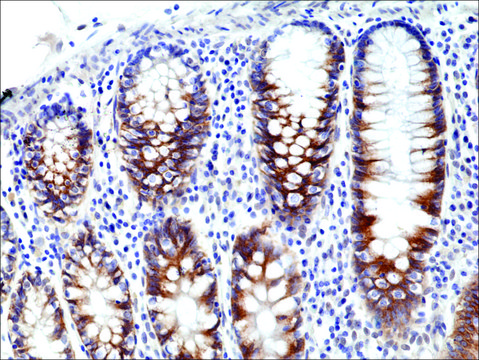 Anti-CD71 antibody, Rabbit monoclonal