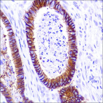Anti-Cadherin -17 antibody, Rabbit monoclonal