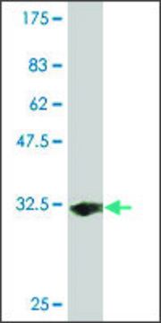Monoclonal Anti-SLC35D2 antibody produced in