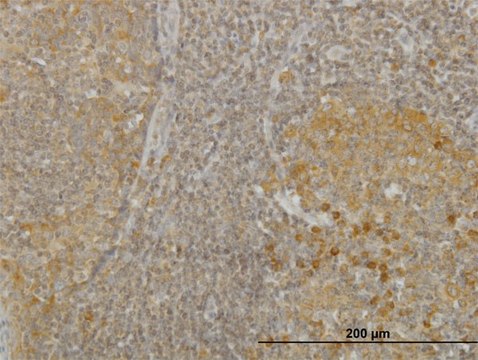 Monoclonal Anti-RGS2 antibody produced in