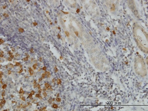 Monoclonal Anti-RRM2 antibody produced in