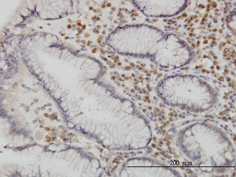 Monoclonal Anti-CAMKK1 antibody produced in