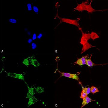 Monoclonal Anti-Mglur1/5 antibody produced in