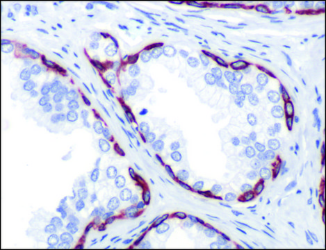 Anti-Keratin 14 antibody, Rabbit monoclonal