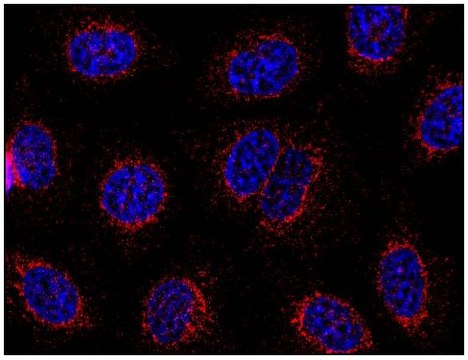 Monoclonal Anti-STIM1 antibody produced in