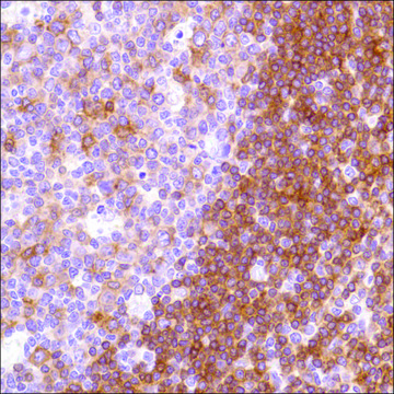 Anti-HLA-DP beta 1 antibody, Rabbit