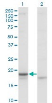 Monoclonal Anti-CRH antibody produced in