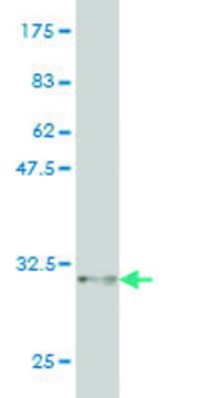 Monoclonal Anti-CDSN antibody produced in