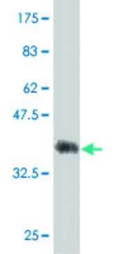 Monoclonal Anti-FLJ31951 antibody produced in