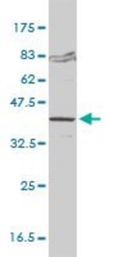 Monoclonal Anti-FVT1 antibody produced in
