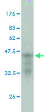 Monoclonal Anti-CDKL5 antibody produced in