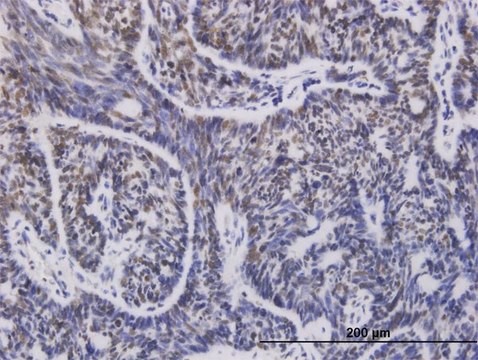 Monoclonal Anti-UBE2D1 antibody produced in