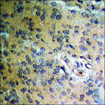 Anti-phospho-B-RAF (pThr???) antibody produced in