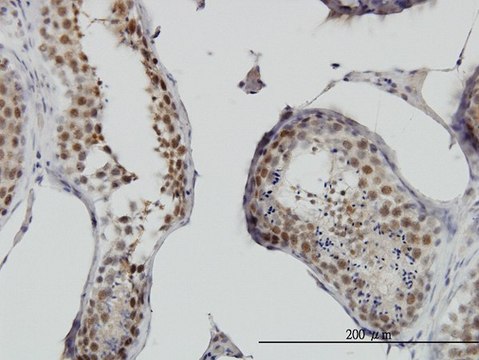 Monoclonal Anti-RNF141 antibody produced in