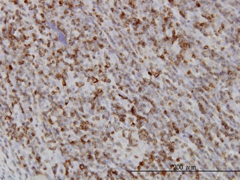 Monoclonal Anti-RAB27A antibody produced in