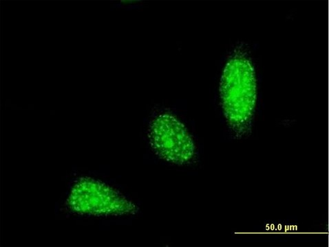 Monoclonal Anti-TRIM31 antibody produced in