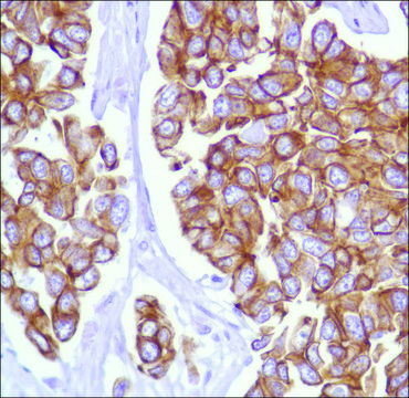 Anti-Keratin 18 antibody, Rabbit monoclonal